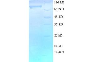 Image no. 1 for DEAD (Asp-Glu-Ala-Asp) Box Polypeptide 27 (DDX27) (AA 30-794), (partial) protein (His-SUMO Tag) (ABIN5711559)