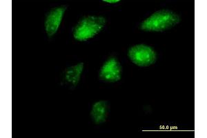 Immunofluorescence of monoclonal antibody to SETDB1 on HeLa cell.