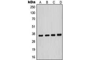 Image no. 2 for anti-Menage A Trois Homolog 1, Cyclin H Assembly Factor (Xenopus Laevis) (MNAT1) (Center) antibody (ABIN2706576)