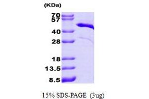 Troponin T Protein (Tn T) (AA 1-285) (His tag)