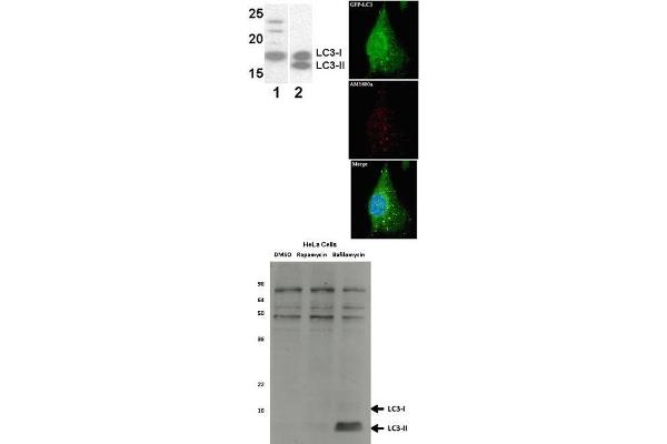 anti-Microtubule-Associated Protein 1 Light Chain 3 alpha (MAP1LC3A) antibody