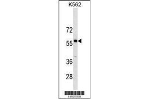 Image no. 1 for anti-Pre-B-Cell Leukemia Transcription Factor 3 (PBX3) (AA 80-108), (N-Term) antibody (ABIN1881636)