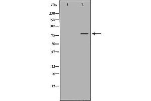 Image no. 2 for anti-ATP-Binding Cassette, Sub-Family G (WHITE), Member 8 (ABCG8) antibody (ABIN6259696)