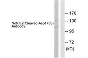 Image no. 1 for anti-Notch 2 (NOTCH2) (AA 1684-1733), (Cleaved-Asp1733) antibody (ABIN1536095)