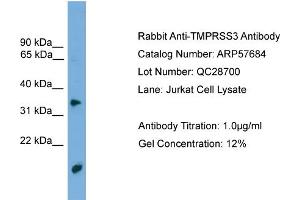 anti-Transmembrane Protease, Serine 3 (TMPRSS3) (N-Term) antibody