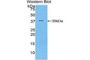 Image no. 1 for anti-Mitochondrially Encoded NADH Dehydrogenase 1 (MT-ND1) (AA 122-171) antibody (ABIN1859975)