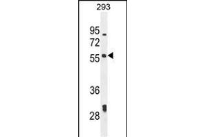 LARP6 antibody  (N-Term)