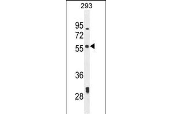 LARP6 antibody  (N-Term)