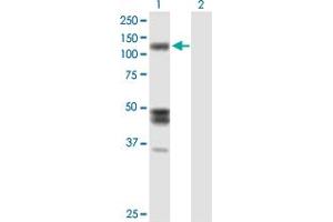 Image no. 2 for anti-Isoleucyl-tRNA Synthetase (IARS) (AA 1-1055) antibody (ABIN516767)