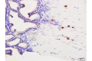 Image no. 1 for anti-Disabled Homolog 1 (Drosophila) (DAB1) (pTyr232) antibody (ABIN684343)