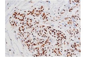 Image no. 9 for anti-Mast/stem Cell Growth Factor Receptor (KIT) (pTyr721) antibody (ABIN6256004)