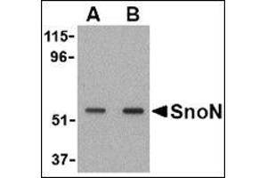 Image no. 2 for anti-SKI-Like Oncogene (SKIL) (N-Term) antibody (ABIN500786)