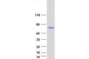 Image no. 1 for serine/threonine Kinase 32C (STK32C) protein (Myc-DYKDDDDK Tag) (ABIN2732874)