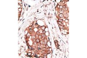 Image no. 2 for anti-Hippocalcin-Like 1 (HPCAL1) (N-Term) antibody (ABIN357110)