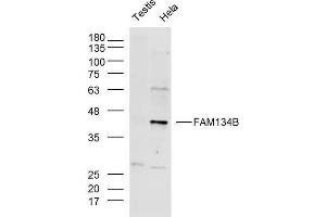 Image no. 2 for anti-Family with Sequence Similarity 134, Member B (FAM134B) (AA 210-310) antibody (ABIN1714363)