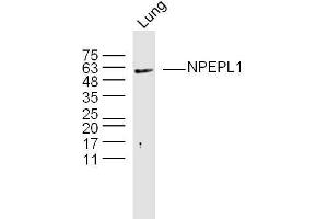 NPEPL1 Antikörper  (AA 371-470)