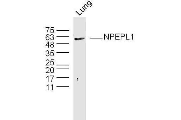 NPEPL1 Antikörper  (AA 371-470)