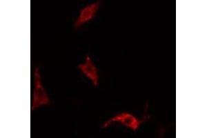 Image no. 1 for anti-Epidermal Growth Factor Receptor Pathway Substrate 15 (EPS15) (pTyr849) antibody (ABIN6256811)