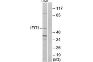 Image no. 1 for anti-Interferon-Induced Protein with Tetratricopeptide Repeats 1 (IFIT1) (AA 41-90) antibody (ABIN1534418)