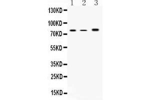 Image no. 1 for anti-Arachidonate 12-Lipoxygenase (ALOX12) (AA 186-231), (N-Term) antibody (ABIN5518730)