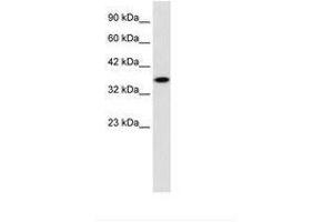 Image no. 2 for anti-Zinc Finger Protein 75 (ZNF75) (AA 209-258) antibody (ABIN202169)