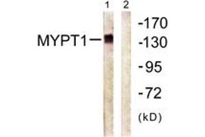 Image no. 1 for anti-Myosin Phosphatase, Target Subunit 1 (PPP1R12A) (AA 661-710) antibody (ABIN1532365)