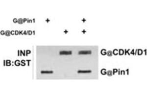 Image no. 1 for anti-Peptidylprolyl Cis/trans Isomerase, NIMA-Interacting 1 (PIN1) (Internal Region) antibody (ABIN233831)