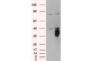 Western Blotting (WB) image for Tissue Factor Pathway Inhibitor (Lipoprotein-Associated Coagulation Inhibitor) (TFPI) peptide (ABIN370020)