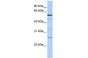 Image no. 1 for anti-Zinc Finger, CCCH-Type with G Patch Domain (ZGPAT) (C-Term) antibody (ABIN632083)