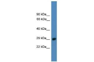 Image no. 1 for anti-Proteasome (Prosome, Macropain) 26S Subunit, Non-ATPase, 9 (PSMD9) (C-Term) antibody (ABIN929206)