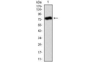 Image no. 5 for anti-Alkaline Phosphatase, Liver/bone/kidney (ALPL) antibody (ABIN969500)