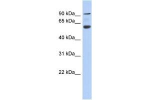 WB Suggested Anti-CENTB5 Antibody Titration: 0.