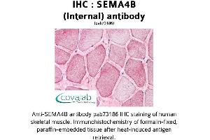 Image no. 2 for anti-Sema Domain, Immunoglobulin Domain (Ig), Transmembrane Domain (TM) and Short Cytoplasmic Domain, (Semaphorin) 4B (SEMA4B) (Internal Region) antibody (ABIN1739127)