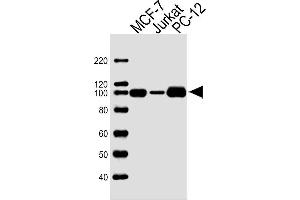 Image no. 1 for anti-Topoisomerase (DNA) I (TOP1) antibody (ABIN4914765)