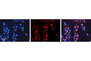PAPSS2 anticorps  (C-Term)
