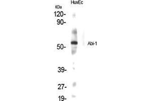Image no. 2 for anti-Abl-Interactor 1 (ABI1) (Internal Region) antibody (ABIN3183132)