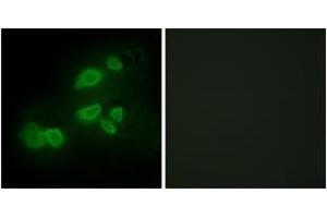 Image no. 2 for anti-CUB Domain Containing Protein 1 (CDCP1) (AA 691-740) antibody (ABIN1534127)