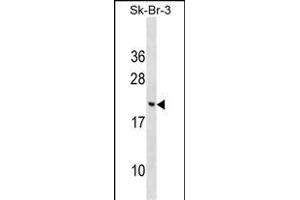 CNIH3 Antibody (N-term) (ABIN1539102 and ABIN2849119) western blot analysis in SK-BR-3 cell line lysates (35 μg/lane).
