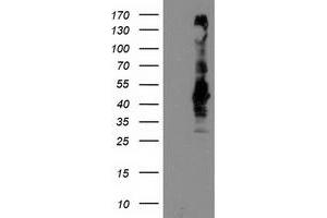 Image no. 2 for anti-SEC14-Like 2 (SEC14L2) antibody (ABIN2731564)