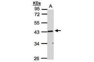 Image no. 2 for anti-RELT Tumor Necrosis Factor Receptor (RELT) (Center) antibody (ABIN2855800)