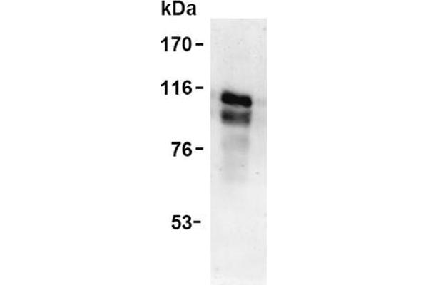 anti-Tumor Necrosis Factor Receptor Superfamily, Member 8 (TNFRSF8) antibody