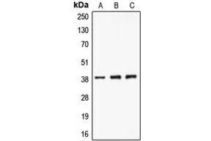 Image no. 1 for anti-Chloride Channel, Nucleotide-Sensitive, 1A (CLNS1A) antibody (ABIN2994159)