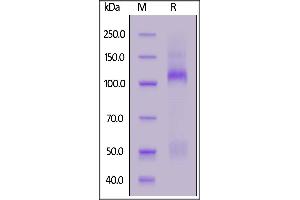 Image no. 2 for Insulin-Like Growth Factor 1 Receptor (IGF1R) (AA 31-936) protein (His tag) (ABIN6253548)