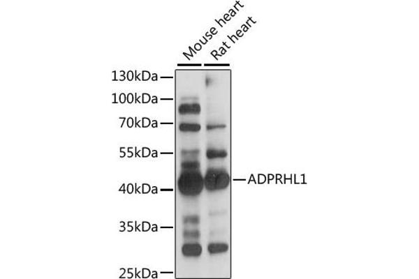 ADPRHL1 anticorps  (AA 80-280)
