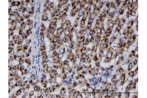 Immunoperoxidase of monoclonal antibody to ACAA1 on formalin-fixed paraffin-embedded human liver.
