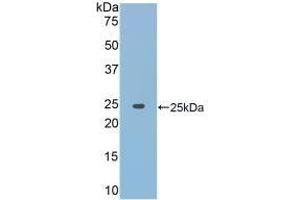 JAK2 Antikörper  (AA 916-1103)
