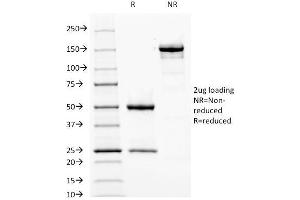 Image no. 7 for anti-Fascin (FSCN1) antibody (ABIN6940607)
