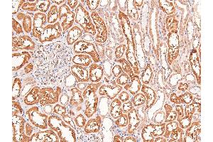 Image no. 1 for anti-Fibroblast Growth Factor Receptor Substrate 2 (FRS2) (pTyr196) antibody (ABIN6271560)
