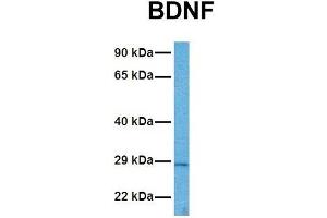 Image no. 4 for anti-Brain-Derived Neurotrophic Factor (BDNF) (Middle Region) antibody (ABIN2777093)