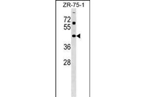 ZN Antibody (Center) (ABIN1538010 and ABIN2849144) western blot analysis in ZR-75-1 cell line lysates (35 μg/lane).